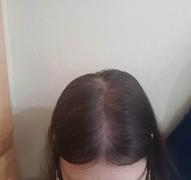 iRESTORE Laser  Review